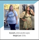 before and after surgery photo featuring tgh north female bariatric surgery patient with text krystal k before and after surgery weight lost 120 lbs